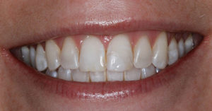 Robinson Dentistry Tracy-before dental care